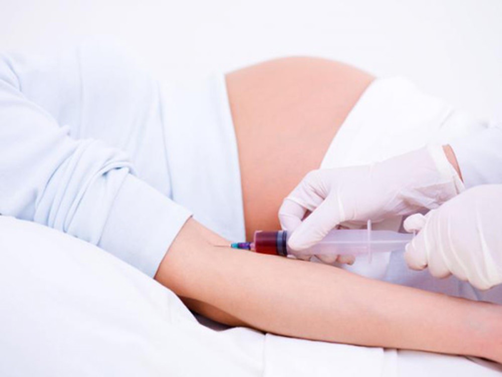 sàng lọc dị tật trước sinh double test
